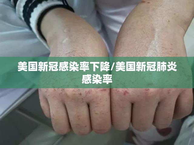 美国新冠感染率下降/美国新冠肺炎感染率