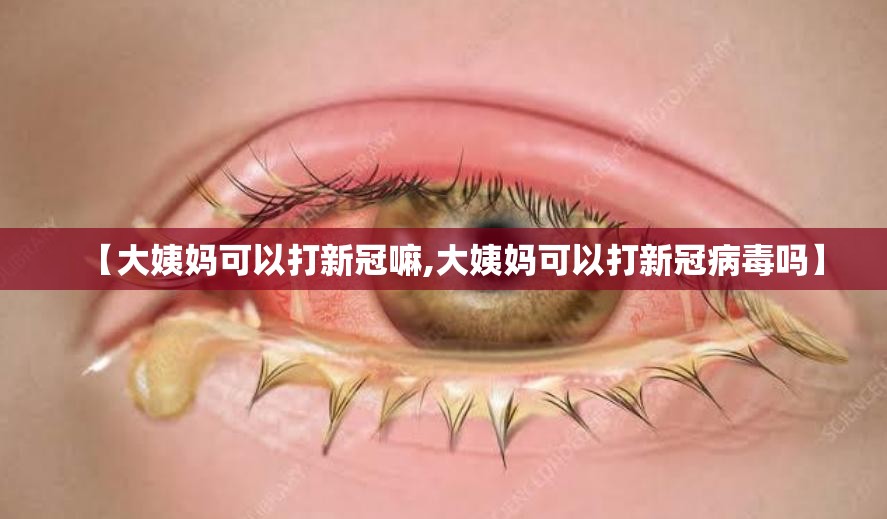 【大姨妈可以打新冠嘛,大姨妈可以打新冠病毒吗】