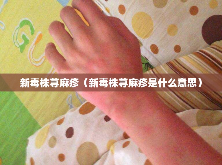 新毒株荨麻疹（新毒株荨麻疹是什么意思）