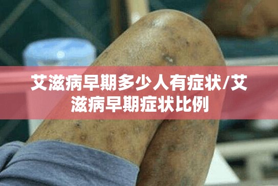 艾滋病早期多少人有症状/艾滋病早期症状比例