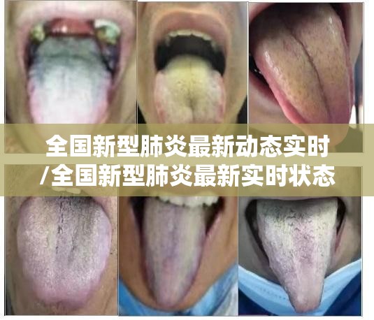 全国新型肺炎最新动态实时/全国新型肺炎最新实时状态